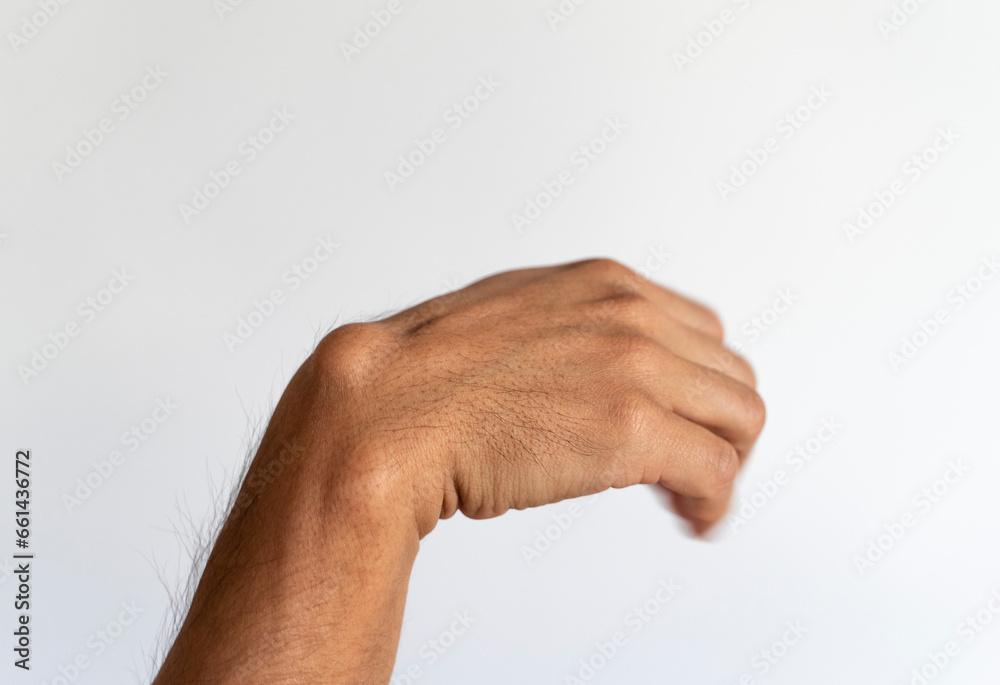 Ganglion cyst on man's hand on white background Ganglion cyst on man's hand on white background
