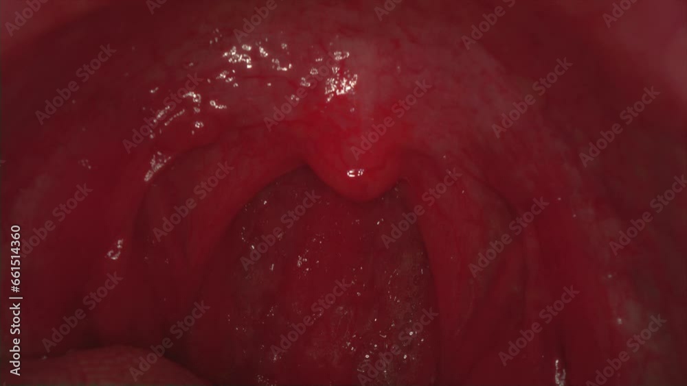 Real video of a human throat. Macro frame inside the mouth. Teeth and