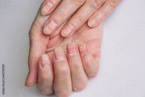 close-up photo of nails with white stripes Fototapeta