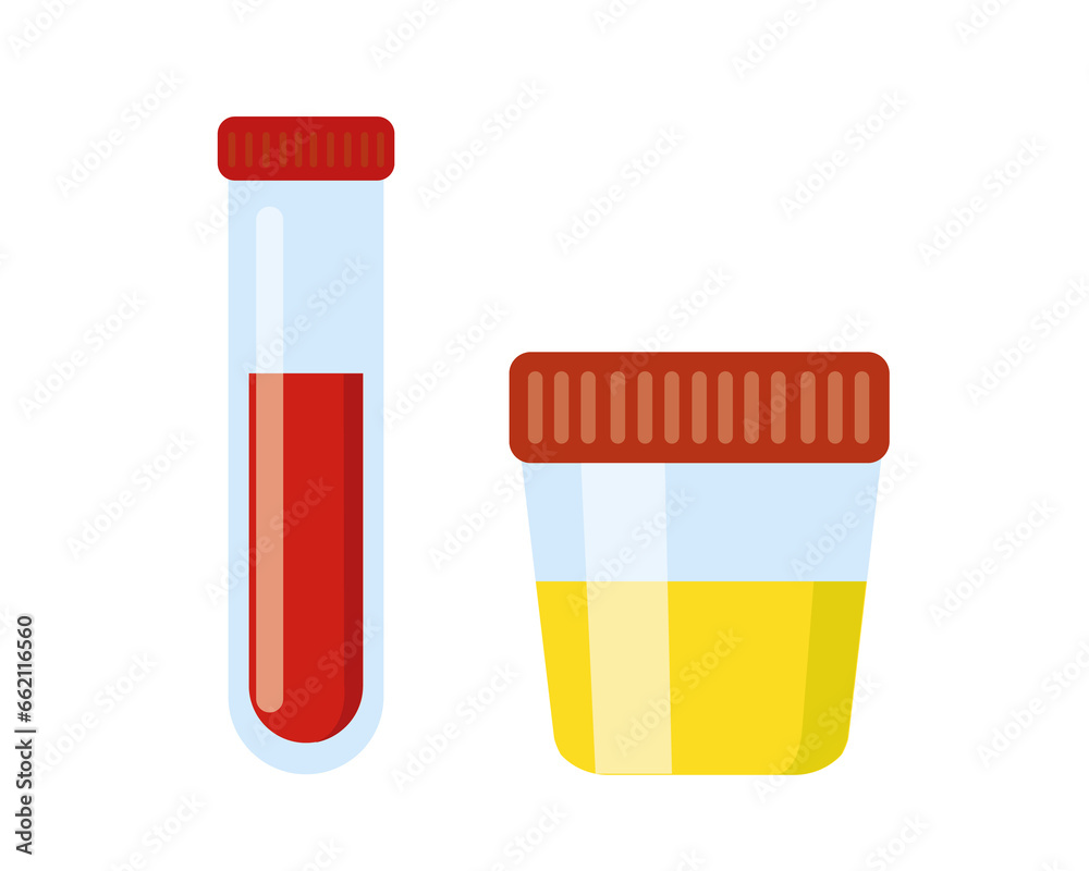 Test tube with blood and urine sample container isolated on white background. Urinalysis, blood medical analysis icons. Laboratory examination and diagnostics concept. Test tube with blood and urine sample container isolated on white background. Urinalysis, blood medical analysis icons. Laboratory examination and diagnostics concept.