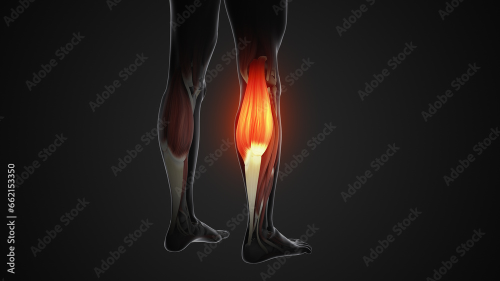 Pain and injury in the Gastrocnemius Muscles Pain and injury in the Gastrocnemius Muscles