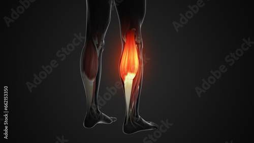 Pain and injury in the Gastrocnemius Muscles