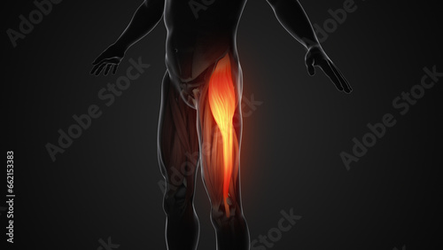 Принти на полотні Pain and injury in the Tensor Fasciae Latae Muscles