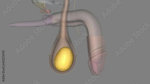 The tunica vaginalis (TV) represents the investing serosal covering of the testis. photo