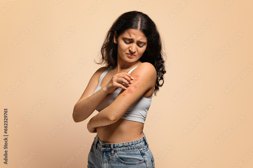 Dermatitis, eczema, allergy, psoriasis concept. Annoyed young indian woman scratching irritated skin - obrazy, fototapety, plakaty 