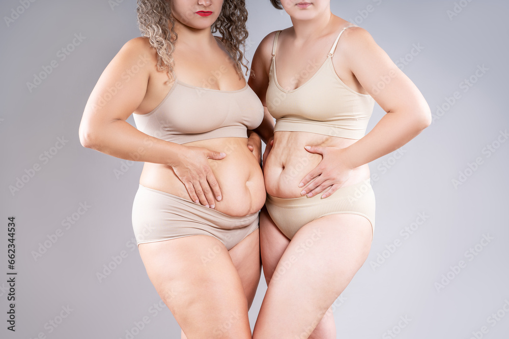Tummy tuck, two fat women with flabby bellies on gray background, plastic surgery and body positive concept - obrazy, fototapety, plakaty 