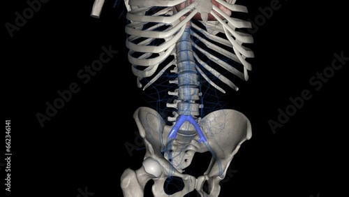 The common iliac vein is formed by the unification of the internal and external iliac veins . photo