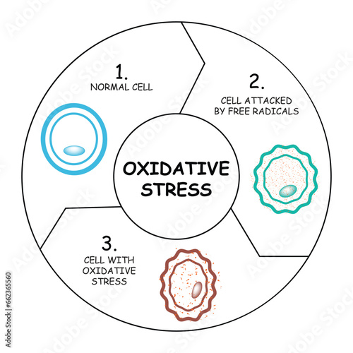 Oxidative Stress, free radicals and antioxidants, Normal Cell, Cell Attacked by Free Radicals, Cell With Oxidative Stress. Vector Illustration. photo