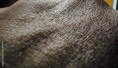  High-res macro shot capturing the unique texture of human skin, detail emphasized.