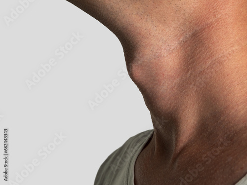 Anatomy of the laryngeal cartilage in men, Adam's apple in men selective focus photo