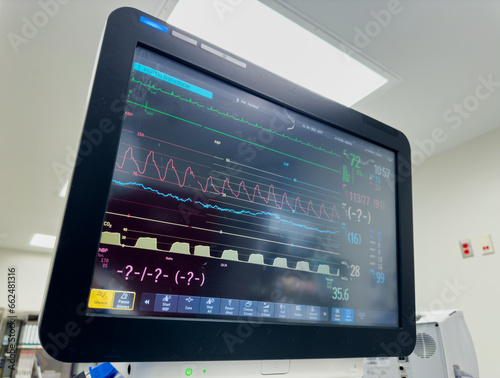hospital monitor displaying vital signs  heart rate  blood pressure  temperature  and pulse oximetry  highlighting advanced medical technology in patient care
