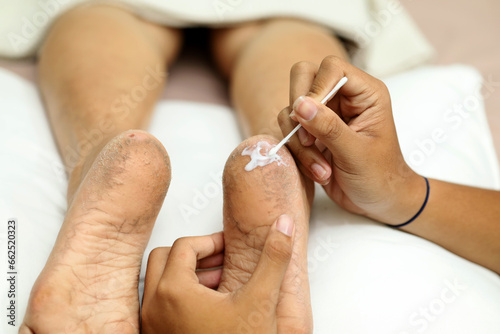 close-up woman applying cream on dry heels in beauty and skin care salon.manicure pedicure service photo