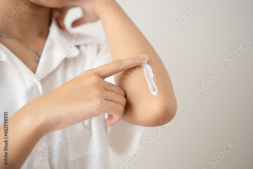 Asian woman applying cream on scarred elbow