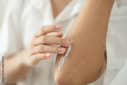 Asian woman applying cream on scarred elbow