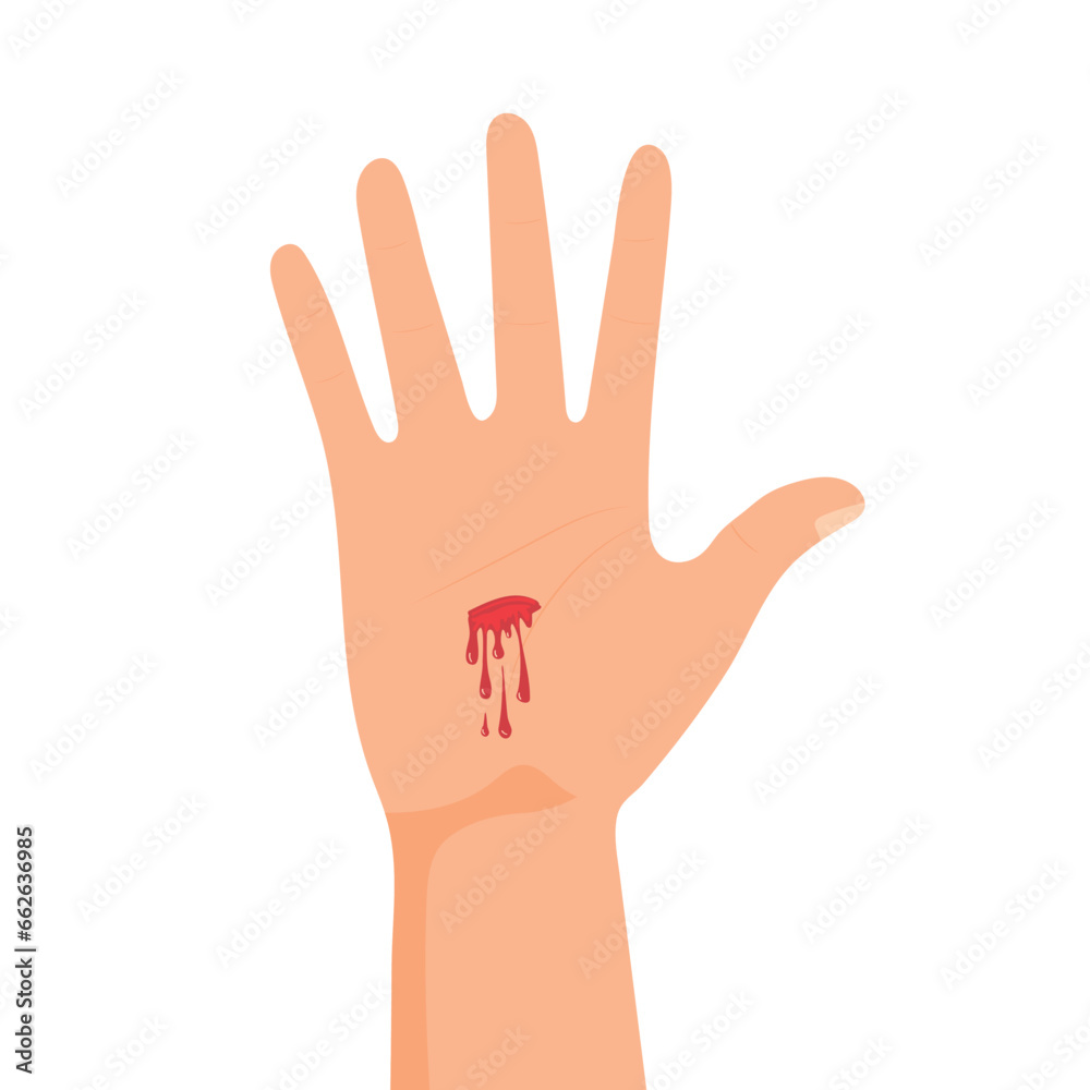 Hand with bleeding cut. Palm wound. Injury icon isolated on white background Hand with bleeding cut. Palm wound. Injury icon isolated on white background