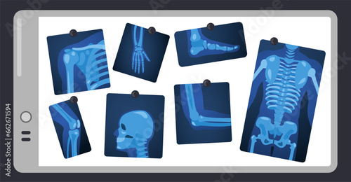 X ray on doctor screen. Human skeleton parts on surgery light pad, body parts medical x-ray concept. Vector illustration