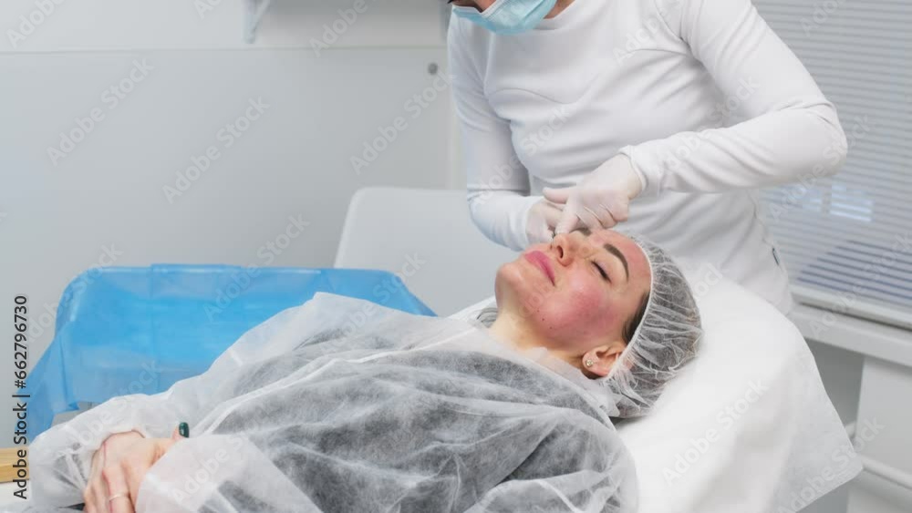 Top view medium close-up shot of platelet rich plasma face injections procedure. PRP Therapy in beauty salon. Young brown-haired female Caucasian patient. Top view medium close-up shot of platelet rich plasma face injections procedure. PRP Therapy in beauty salon. Young brown-haired female Caucasian patient.