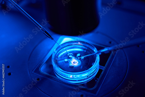 Closeup of ICSI procedure being carried out in Petri dish