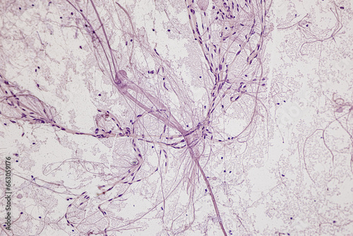 Motor Neuron, Spinal cord, Nerve fibres and nerve cells under the microscope in Lab.