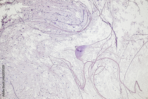 Motor Neuron, Spinal cord, Nerve fibres and nerve cells under the microscope in Lab. photo