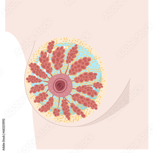 Breast implant under the mammary gland. Internal anatomy front view diagram. Vector illustration