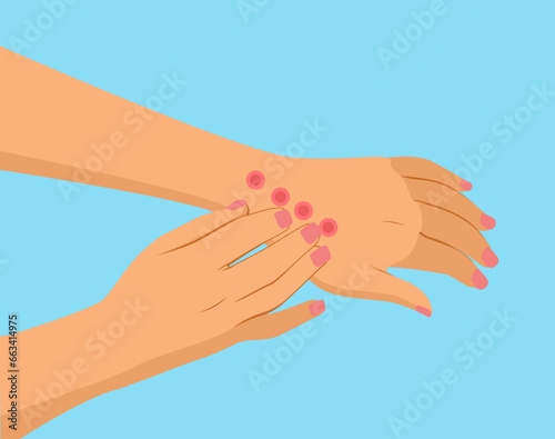 Patient with bed bug bite vector illustration on blue background. Arms with rash cartoon drawing