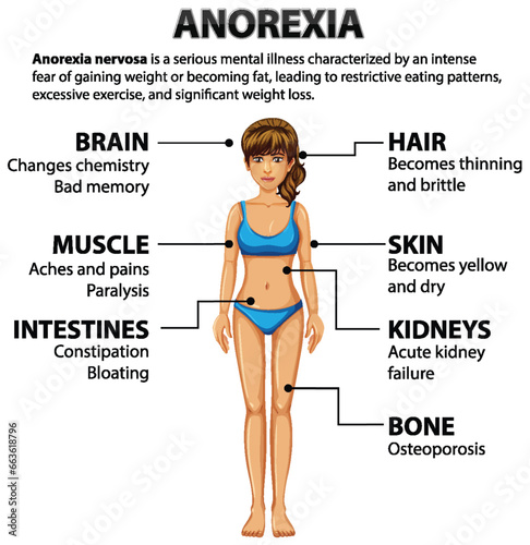 Effects of Anorexia on Female Anatomy