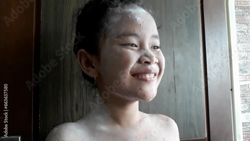 close up portrait of elementary age girl using powder for itching due to chickenpox. Wellness home care treatment chickenpox because varicella zoster virusv photo
