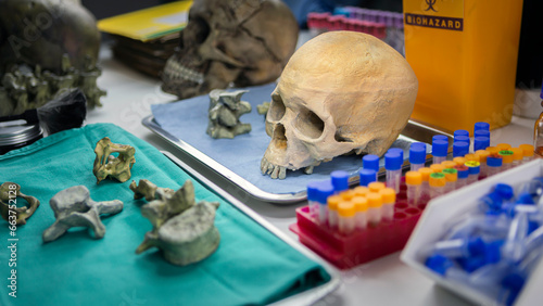 Several human skulls next to petri dish with bone remains to determine DNA in forensic laboratory