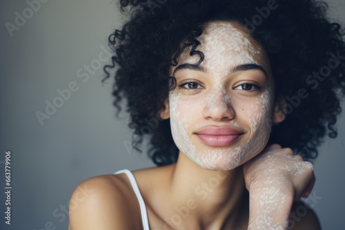 Black girl with vitilingo. photo