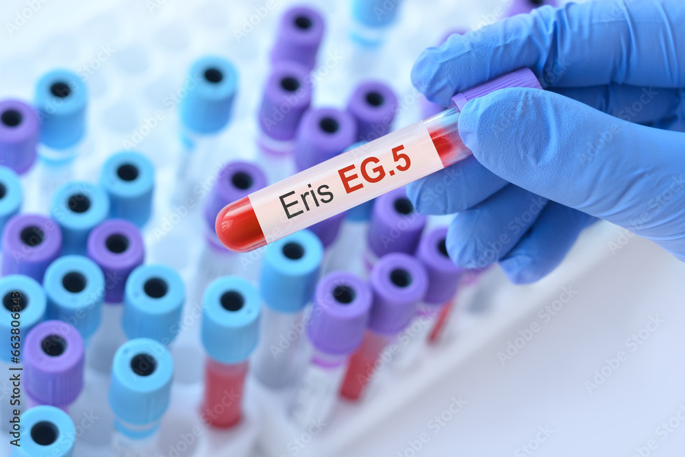 Obraz premium Doctor holding a test blood sample tube for the detection of the new Omicron variant Eris EG.5 on the background of medical test tubes.