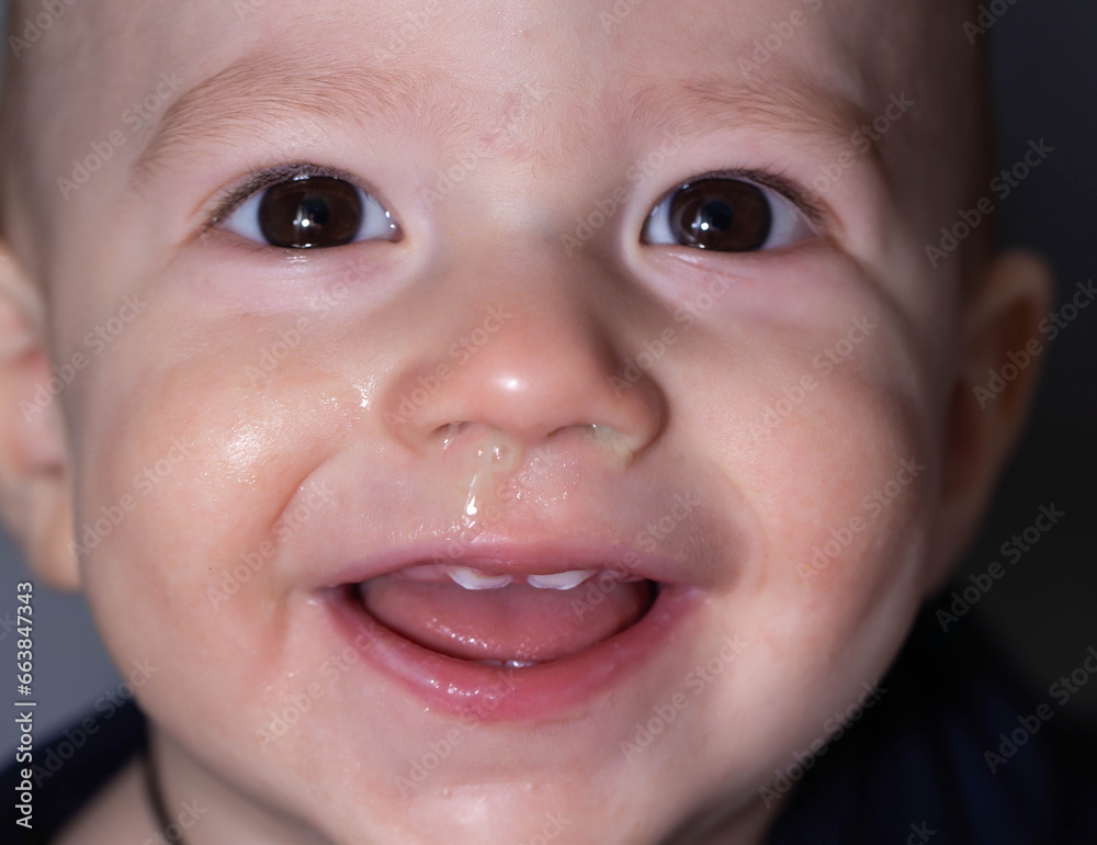 Face of a smiling baby boy with snot from his nose. Runny nose and nasal congestion in children. Virus and bacterial infection, close-up Face of a smiling baby boy with snot from his nose. Runny nose and nasal congestion in children. Virus and bacterial infection, close-up