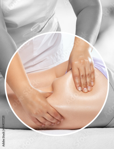 Masseur makes anti-cellulite massage on the legs, thighs, hips and buttocks in the spa. Overweight treatment, body sculpting.Cosmetology and massage concept.