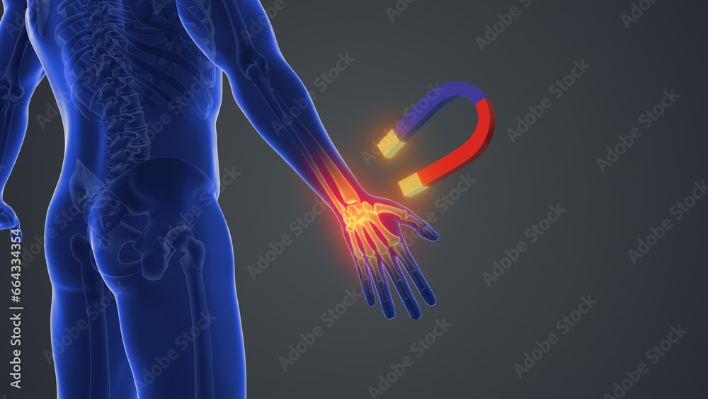 Magnet therapy for wrist joint pain	
 - obrazy, fototapety, plakaty 