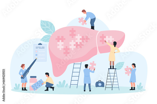 Liver disease diagnosis and treatment, hepatology vector illustration. Cartoon tiny people holding pieces of puzzle jigsaw to fit into big human organ, diagnostic examination by hepatologists
