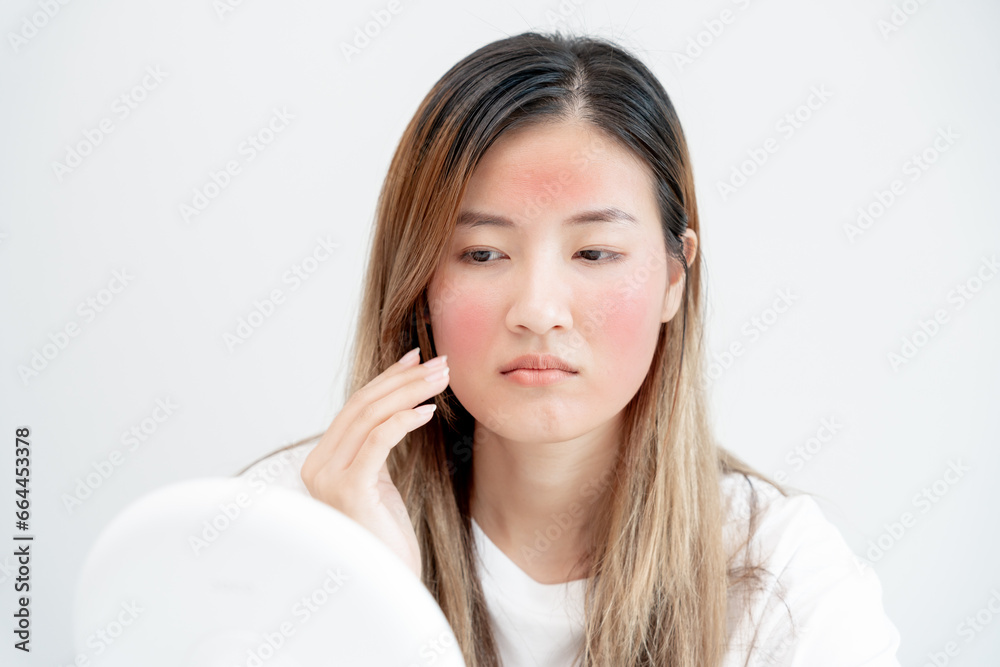 Young woman asian are worried about faces Dermatology and allergic to steroids in cosmetics. sensitive skin, red face from sunburn, acne, allergic to chemicals, rash on face. skin problems and beauty Young woman asian are worried about faces Dermatology and allergic to steroids in cosmetics. sensitive skin, red face from sunburn, acne, allergic to chemicals, rash on face. skin problems and beauty