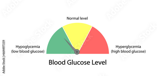 Blood Glucose Levels. Normal level, hypoglycemia (low blood sugar), hyperglycemia (high blood sugar), sugar test. vector diagram