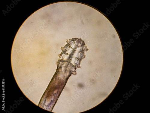 Demodex folliculorum - parasitic mite on the eyelashes of a human eye