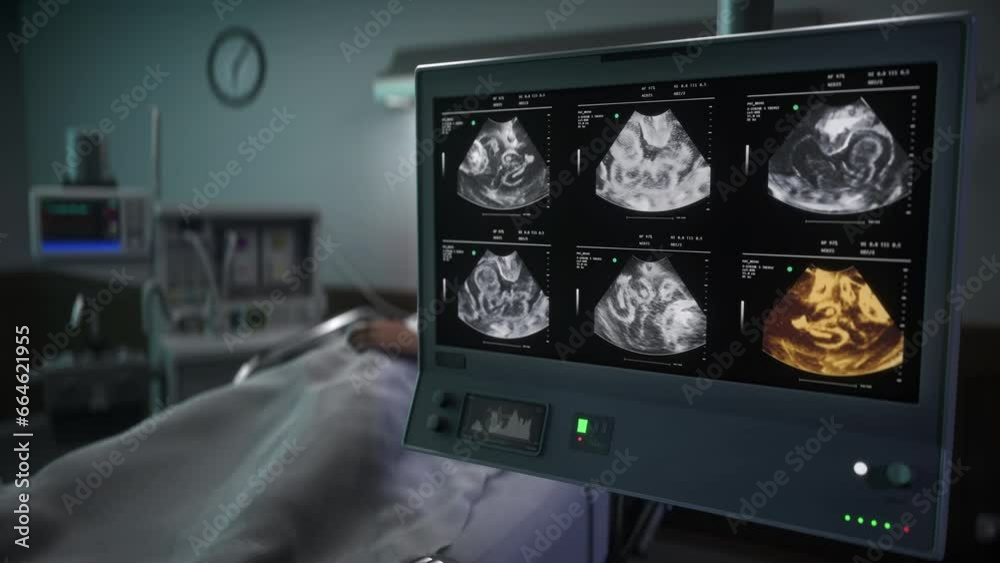 Scanner With Multiple Screens Showing Baby For Health Examination