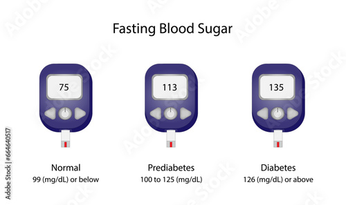 Fasting blood sugar level to measure blood glucose and diagnose diabetes. Glucometer. Medical Equipment for diabetes diagnosis. Vector illustration.
