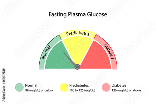 Fasting plasma glucose level to measure blood glucose and diagnose diabetes. Vector illustration.