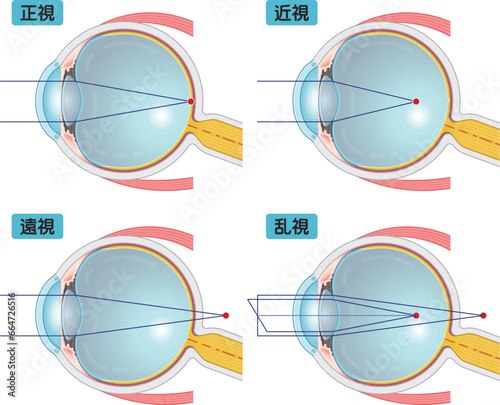 眼球、近視、遠視、老眼、乱視のイラスト・eye・illustration