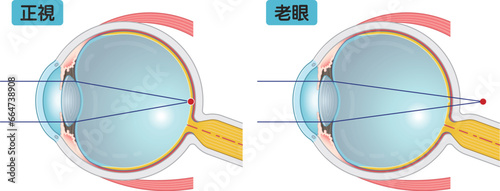 近視、遠視、老眼、乱視、myopia、hyperopia、presbyopia、astigmatism・eye・illustration