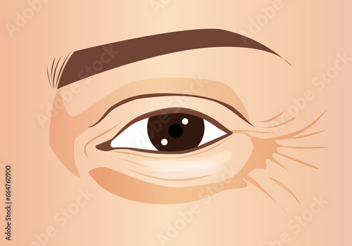 Schilderij op canvas Close-up eye with crow's feet eyes and puffy eye bag area, illustration