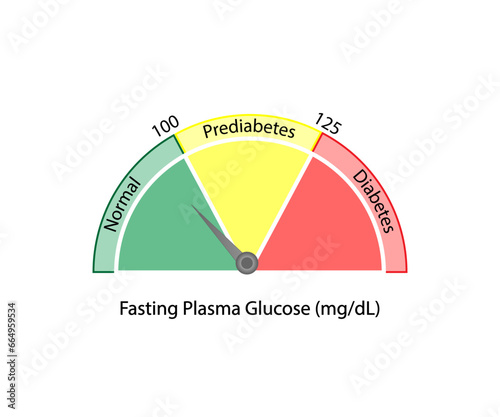 Fasting plasma glucose level to measure blood glucose and diagnose diabetes. Vector illustration.	