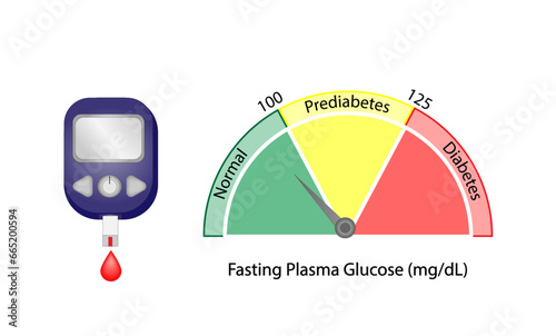 Fasting plasma glucose level to measure blood glucose and diagnose diabetes. Vector illustration.