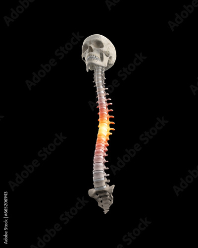 Human spine with lumbar with pain in thoracic region photo