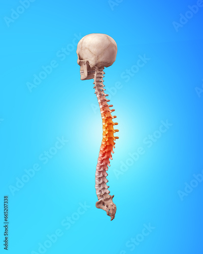 Human spine with lumbar with pain in thoracic region photo