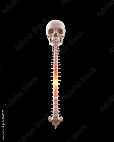 Human spine with lumbar with pain in thoracic region photo