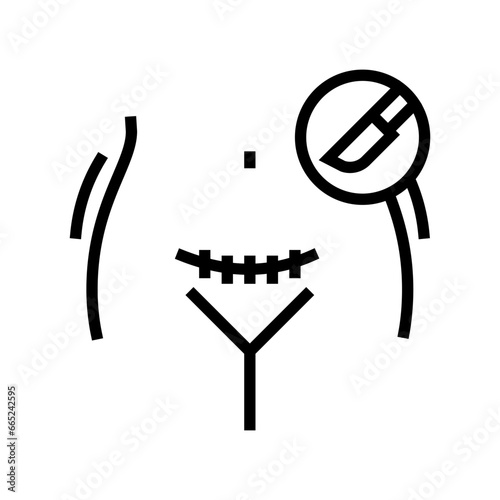 cesarean section gynecologist line icon vector. cesarean section gynecologist sign. isolated contour symbol black illustration